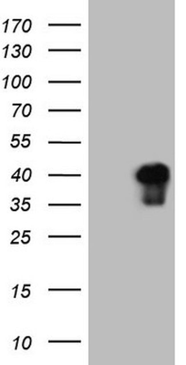 ATF1 Antibody in Western Blot (WB)