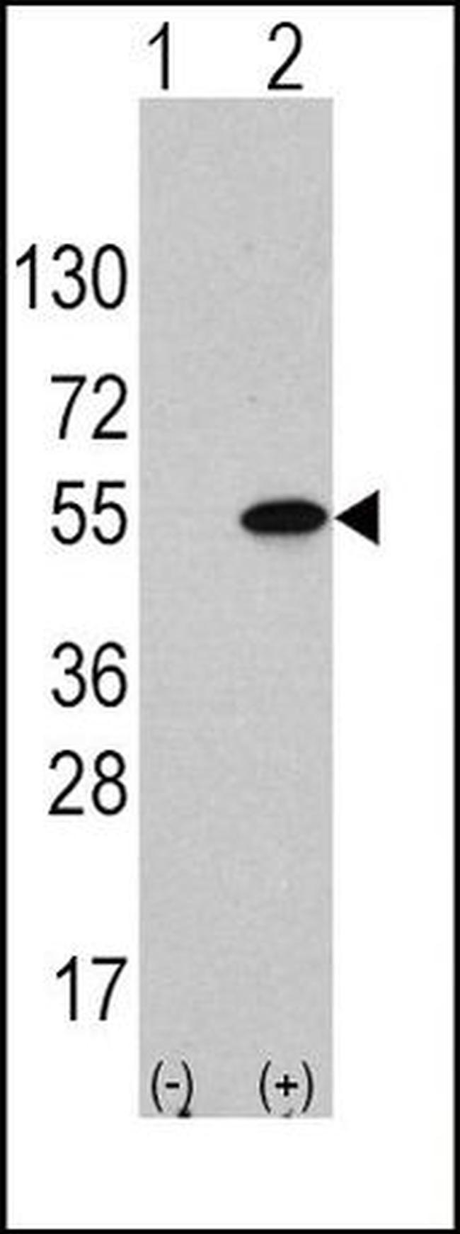ATF4 Antibody in Western Blot (WB)