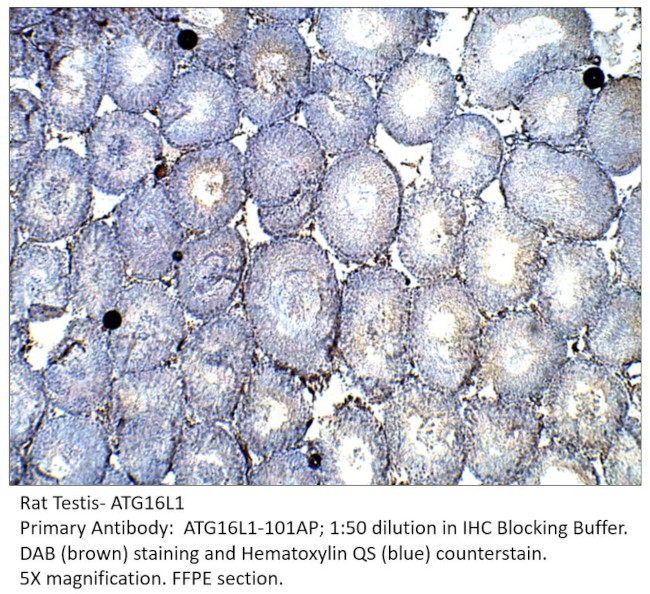 ATG16L1 Antibody in Immunohistochemistry (IHC)