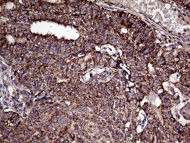 ATG4B Antibody in Immunohistochemistry (Paraffin) (IHC (P))