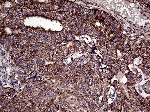 ATG4B Antibody in Immunohistochemistry (Paraffin) (IHC (P))