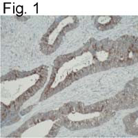 ATIC Antibody in Immunohistochemistry (IHC)
