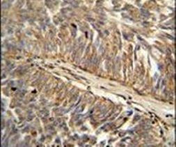 ATP13A3 Antibody in Immunohistochemistry (IHC)
