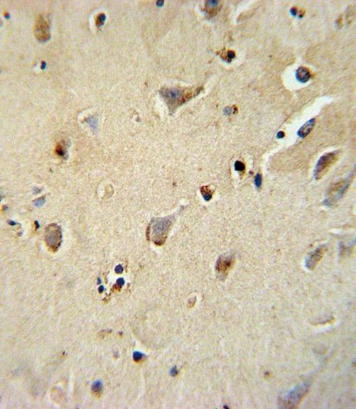 ATP1B1 Antibody in Immunohistochemistry (IHC)