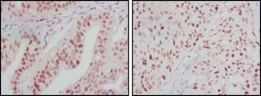 ATP2C1 Antibody in Immunohistochemistry (Paraffin) (IHC (P))