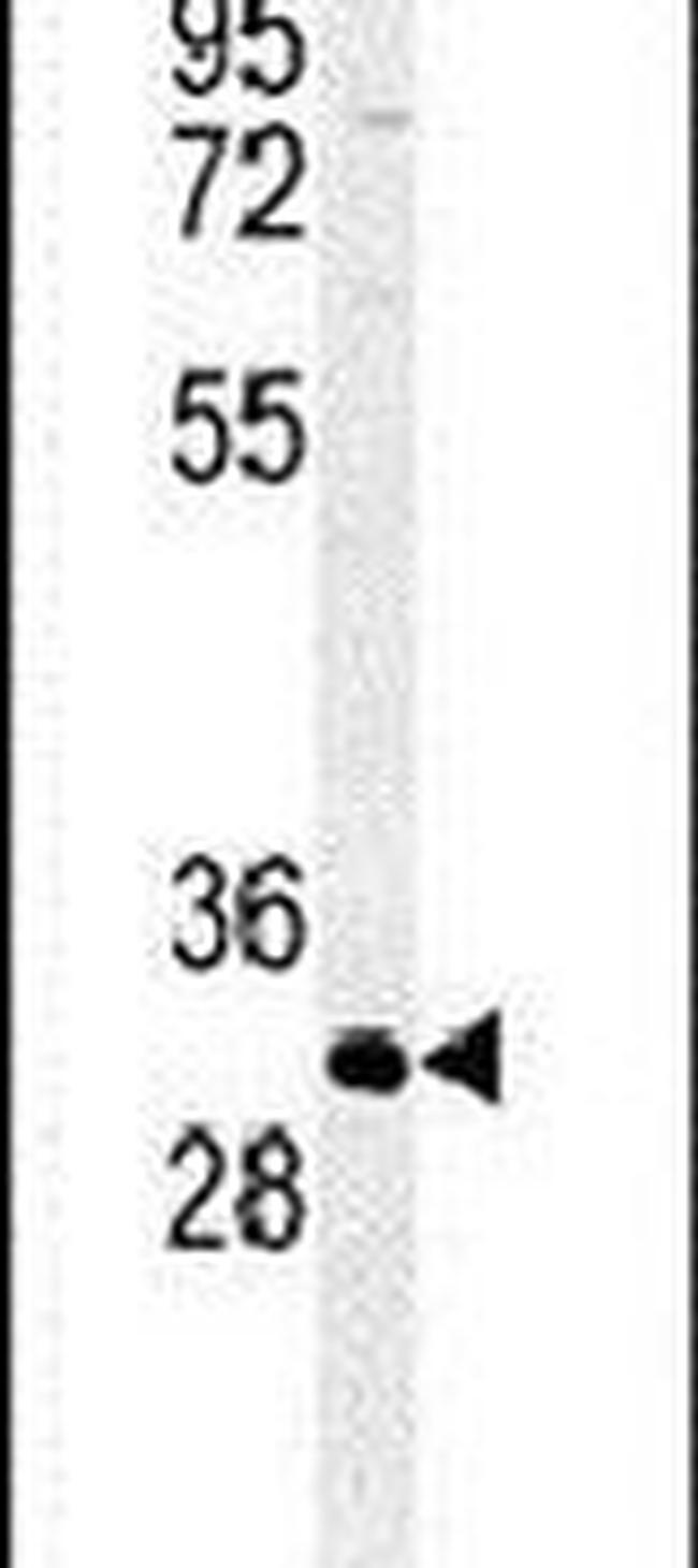 ATP4B Antibody in Western Blot (WB)