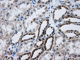 ATP5B Antibody in Immunohistochemistry (Paraffin) (IHC (P))