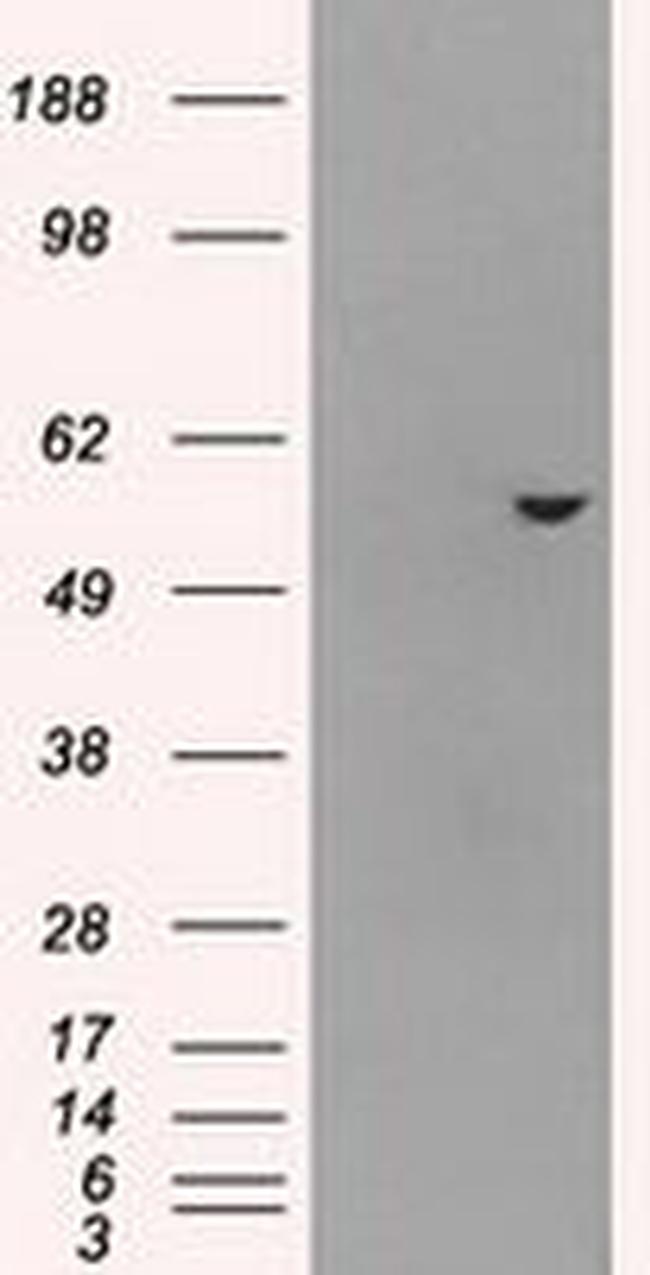 ATP5B Antibody in Western Blot (WB)