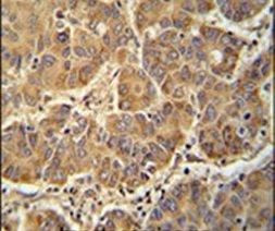ATP5D Antibody in Immunohistochemistry (IHC)