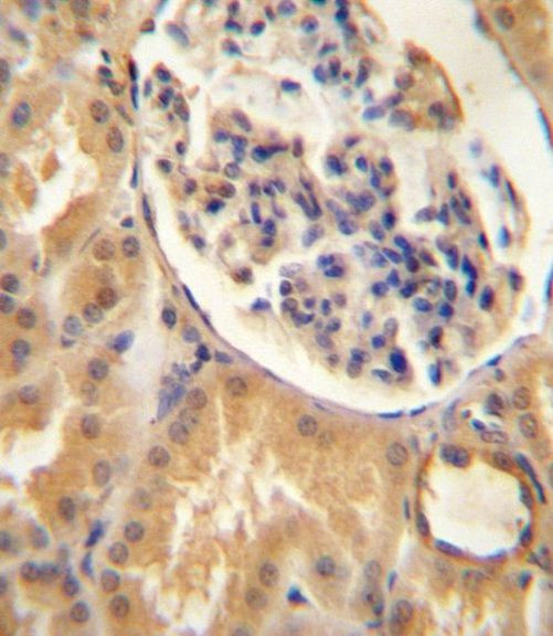 ATP6V0A1 Antibody in Immunohistochemistry (IHC)