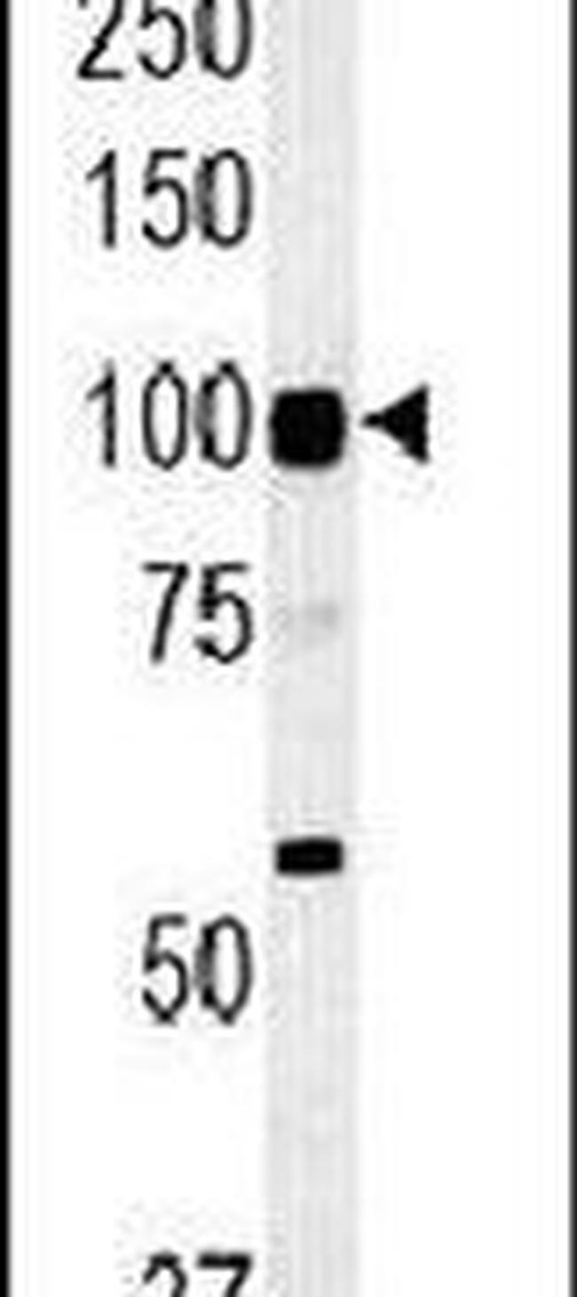 ATP6V0A4 Antibody in Western Blot (WB)
