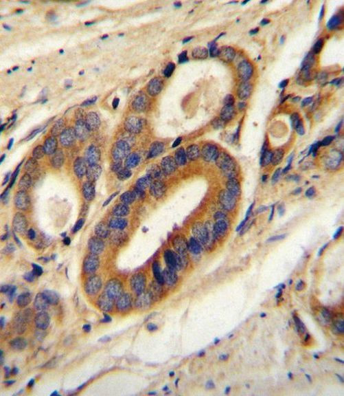 ATP6V0B Antibody in Immunohistochemistry (IHC)