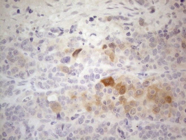 ATP6V1C2 Antibody in Immunohistochemistry (Paraffin) (IHC (P))