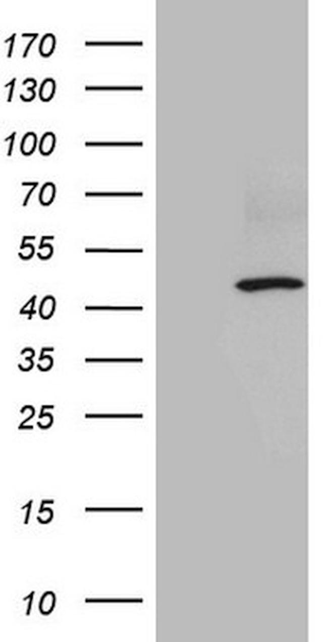ATP6V1C2 Antibody in Western Blot (WB)