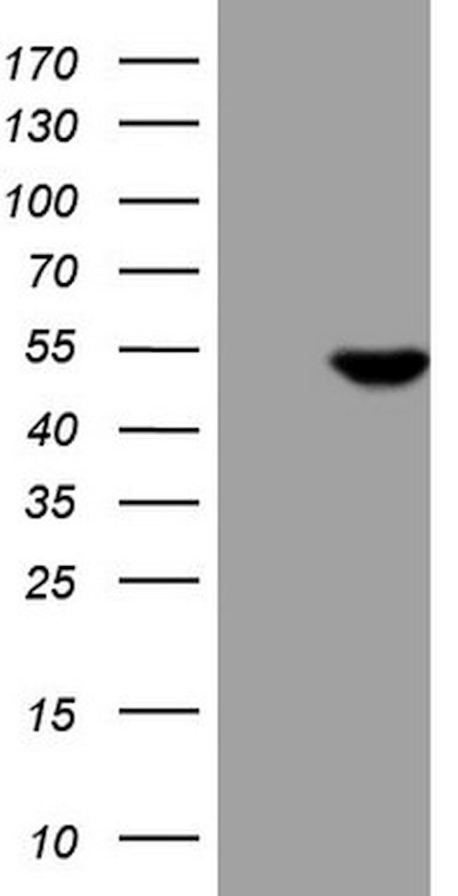 ATP6V1C2 Antibody in Western Blot (WB)