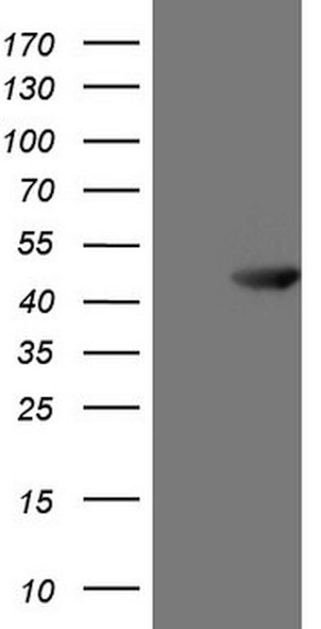 ATP6V1C2 Antibody in Western Blot (WB)