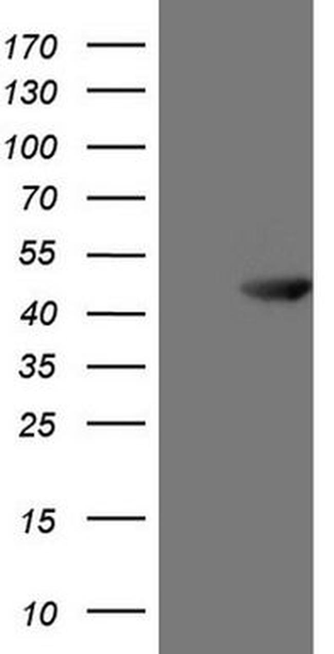 ATP6V1C2 Antibody in Western Blot (WB)