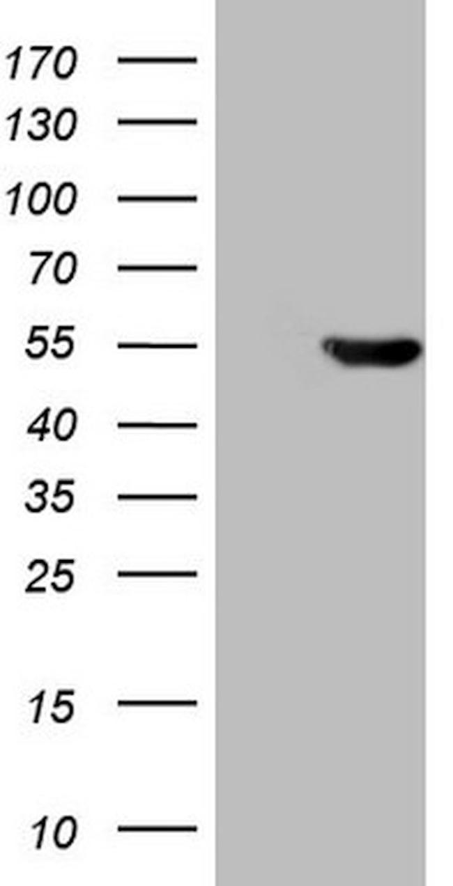 ATP6V1C2 Antibody in Western Blot (WB)