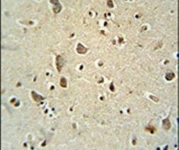 ATPGD1 Antibody in Immunohistochemistry (IHC)
