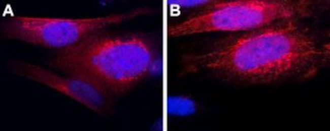 TRHR1 Antibody in Immunocytochemistry (ICC/IF)
