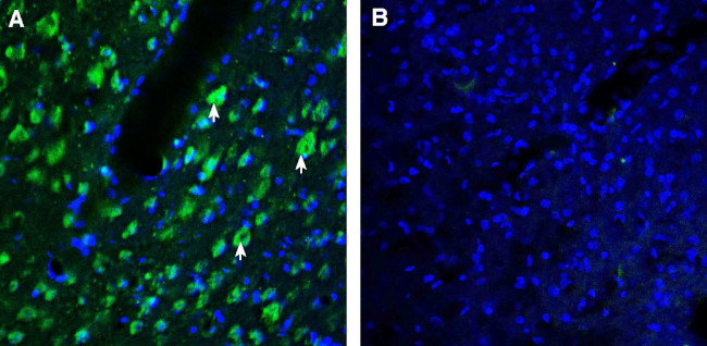 AXL (extracellular) Antibody in Immunohistochemistry (Frozen) (IHC (F))