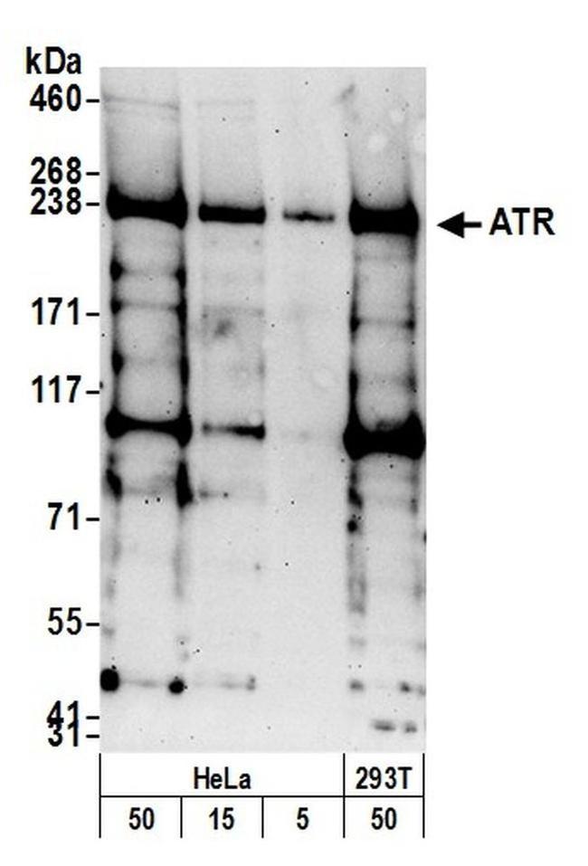 Atr Body Check ATR Polyclonal Antibody (A300-137A-T)