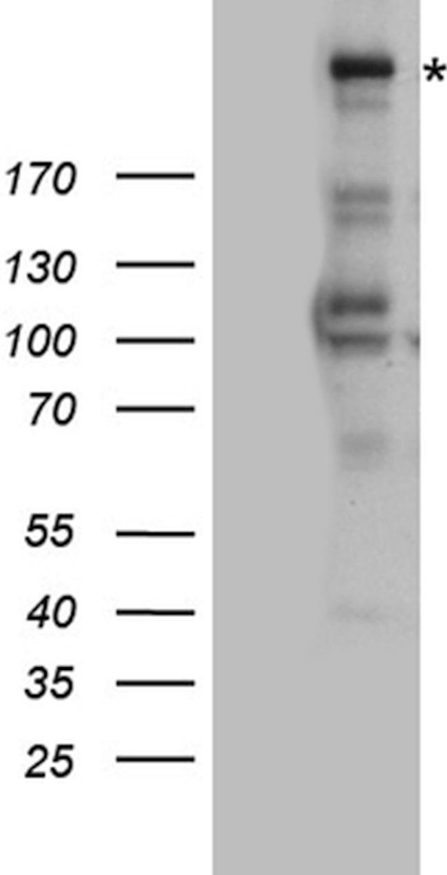 ATR Antibody in Western Blot (WB)