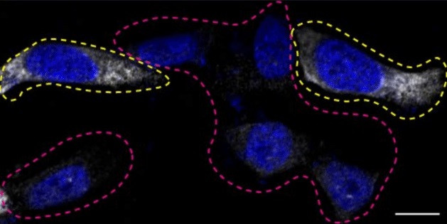 Ataxin 2 Antibody in Immunocytochemistry (ICC/IF)