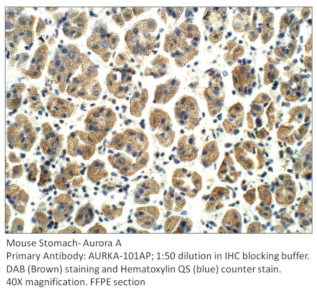 Aurora A Antibody in Immunohistochemistry (Paraffin) (IHC (P))