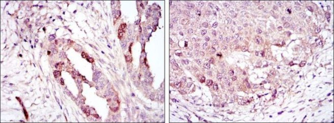 Aurora A Antibody in Immunohistochemistry (Paraffin) (IHC (P))