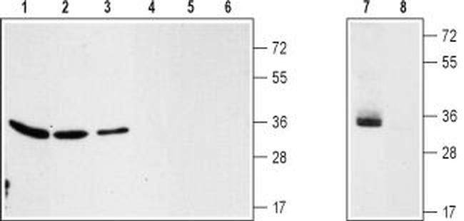 VDAC Antibody in Western Blot (WB)