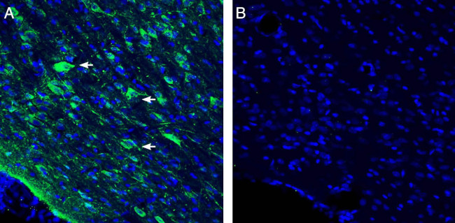 Vasopressin V1A Receptor (AVPR1A) Antibody in Immunohistochemistry (Frozen) (IHC (F))