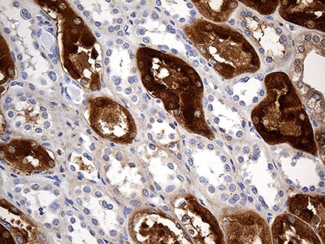 AZGP1 Antibody in Immunohistochemistry (Paraffin) (IHC (P))