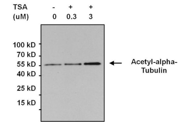 Acetylated Lysine Antibody in Immunoprecipitation (IP)