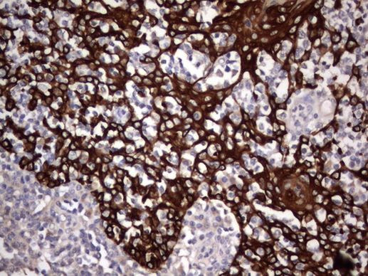 Acidic Cytokeratin Antibody in Immunohistochemistry (Paraffin) (IHC (P))