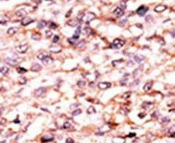 ACVR1C Antibody in Immunohistochemistry (IHC)