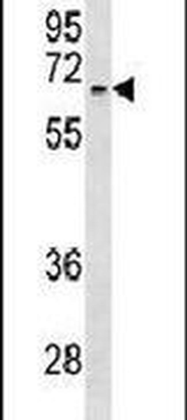 ACVR1 Antibody in Western Blot (WB)
