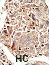 ACVR1 Antibody in Immunohistochemistry (IHC)