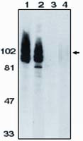 ADAM17 Antibody in Western Blot (WB)
