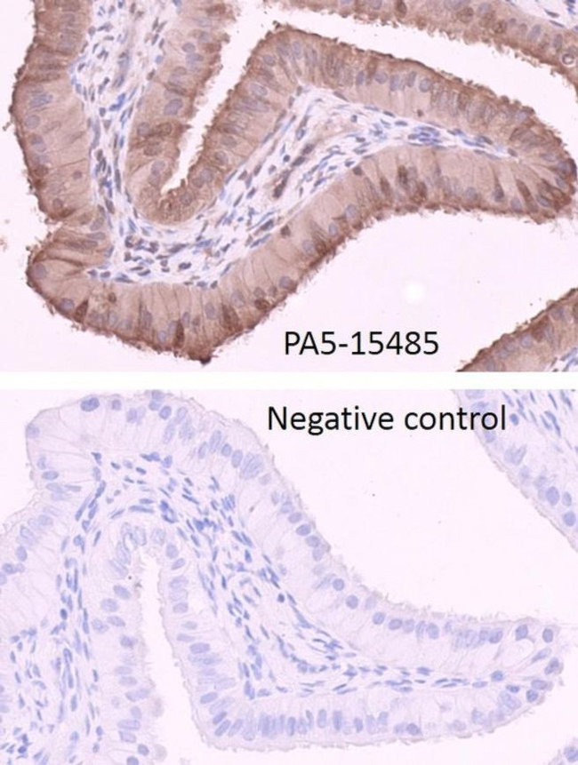Adenylate Kinase 1 Antibody in Immunohistochemistry (IHC)