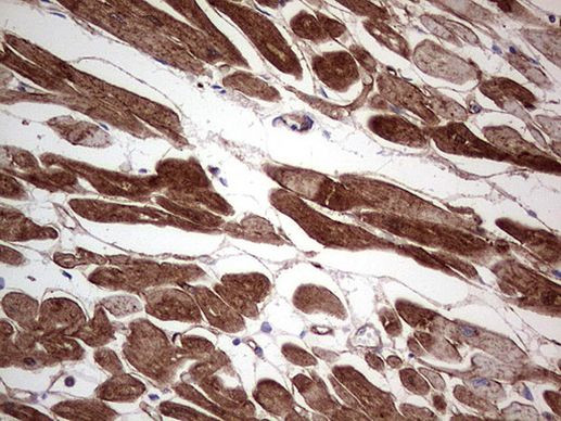 Adiponectin Antibody in Immunohistochemistry (Paraffin) (IHC (P))
