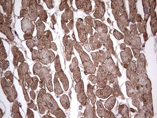 Adiponectin Antibody in Immunohistochemistry (Paraffin) (IHC (P))