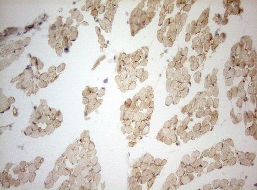 Adiponectin Antibody in Immunohistochemistry (Paraffin) (IHC (P))