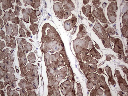Adiponectin Antibody in Immunohistochemistry (Paraffin) (IHC (P))
