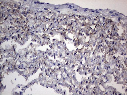 Adiponectin Antibody in Immunohistochemistry (Paraffin) (IHC (P))