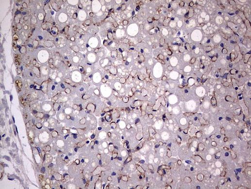 Adiponectin Antibody in Immunohistochemistry (Paraffin) (IHC (P))