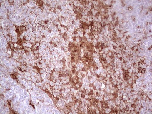 Adiponectin Antibody in Immunohistochemistry (Paraffin) (IHC (P))
