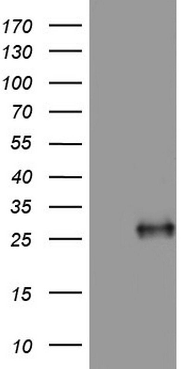 Adiponectin Antibody in Western Blot (WB)