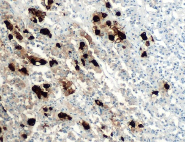 POMC Antibody in Immunohistochemistry (IHC)