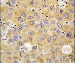 alanyl-tRNA Synthetase Antibody in Immunohistochemistry (IHC)